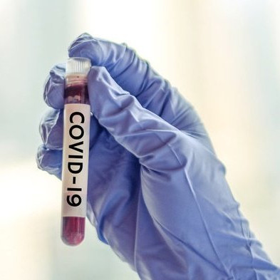 Kasus Sembuh Covid-19 Bertambah 1.914 Kasus